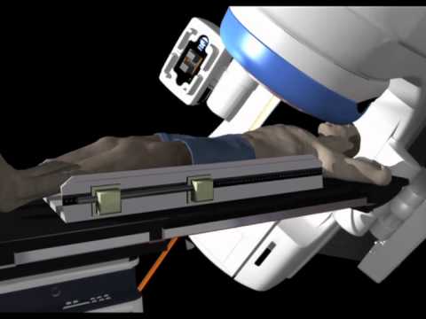 Descubre los beneficios de los Colimadores Multilaminas para la ...